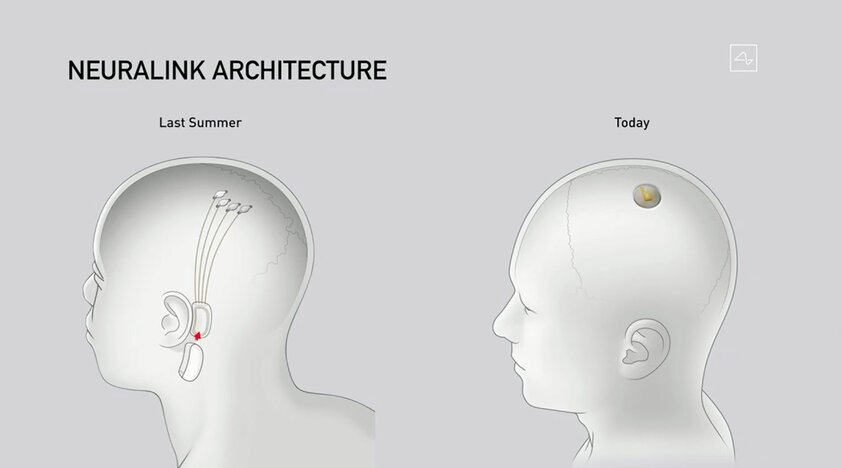 Илон Маск показал свинью с вживлённым в мозг чипом Neuralink и продемонстрировал его работу