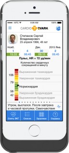 Специалисты из России создали чехол-кардиомонитор для iPhone