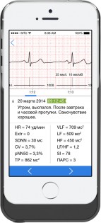 Специалисты из России создали чехол-кардиомонитор для iPhone