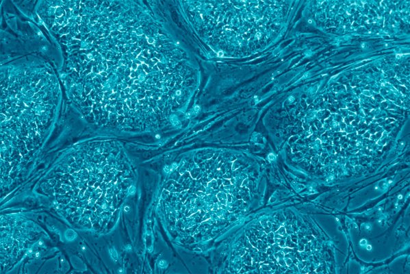 Перепрограммирование иммунных клеток поможет в борьбе с раком