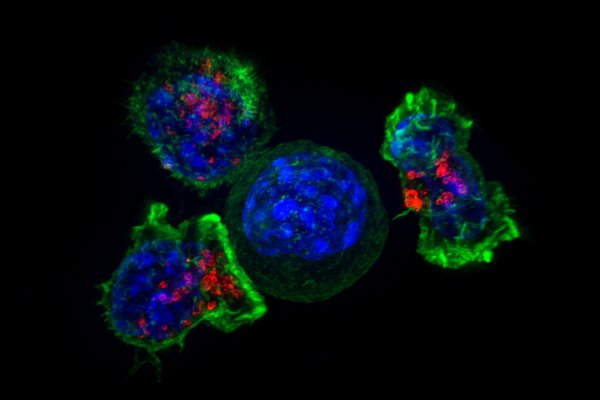 Перепрограммирование иммунных клеток поможет в борьбе с раком