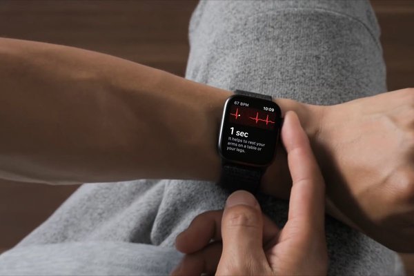 Кардиологи не советуют доверять показаниям ЭКГ в Apple Watch