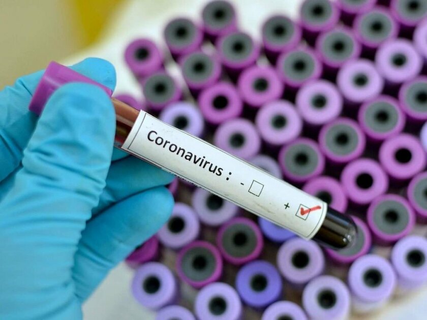 Многие российские СМИ неправильно перевели название лекарства от коронавируса