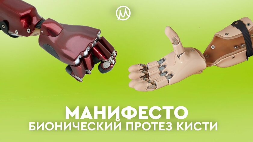 В России запустили производство высокотехнологичных протезов: их можно настраивать через смартфон