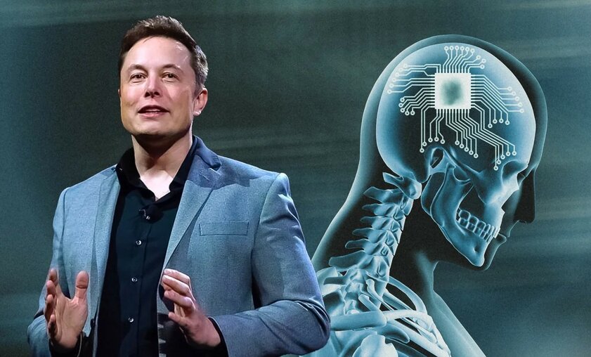 Илон Маск заявил, что Neuralink имплантирует чип в голову человека в ближайшие полгода