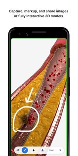BioDigital Human – 3D Anatomy 147.0. Скриншот 5