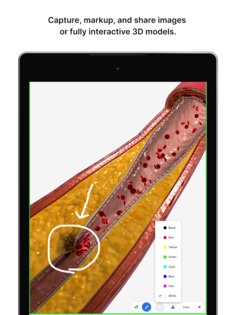 BioDigital Human – 3D Anatomy 147.0. Скриншот 11