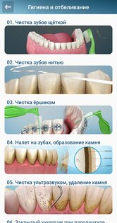 Стоматология - 3D иллюстрации 2.1.101. Скриншот 4