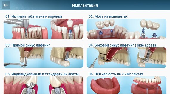 Стоматология - 3D иллюстрации 2.1.101. Скриншот 10