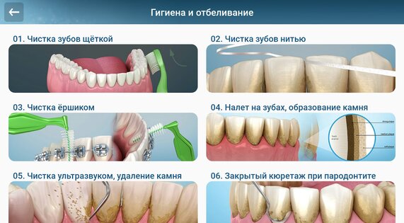Стоматология - 3D иллюстрации 2.1.101. Скриншот 12
