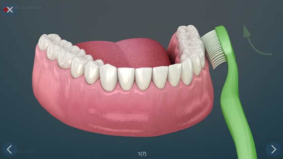 Стоматология - 3D иллюстрации 2.1.101. Скриншот 27