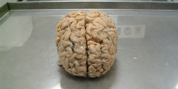 Учёные напечатали мозг