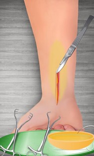 Bone Doctor Wrist Surgery 2.0.5. Скриншот 4