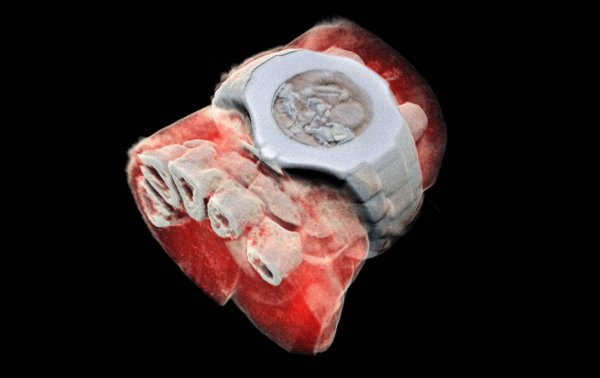 Ученые создали первый в мире цветной 3D-рентген аппарат