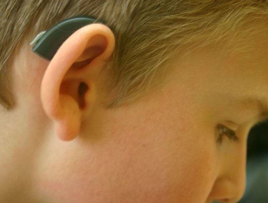 В Android появится нативная поддержка слуховых аппаратов