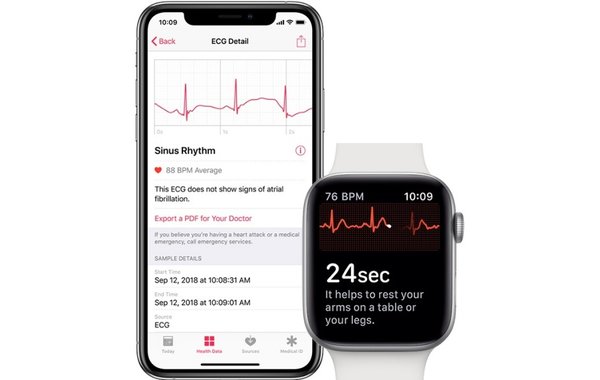 Samsung перенесет главные фишки Apple Watch в свои часы