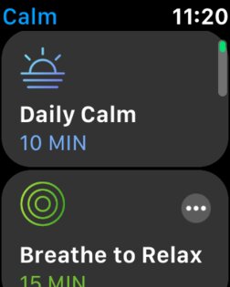 Apple Watch — лучшие умные часы. Так ли это?