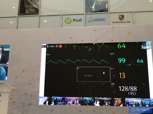 В России провели 5G-трансляцию хирургической операции