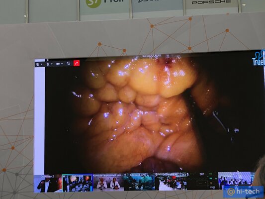 В России провели 5G-трансляцию хирургической операции