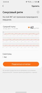 Обзор новых умных часов Samsung Galaxy Watch 3: горстка долгожданных функций