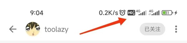 Раскрыты новые функции MIUI 14: лёгкий режим, кастомизация виджетов и не только