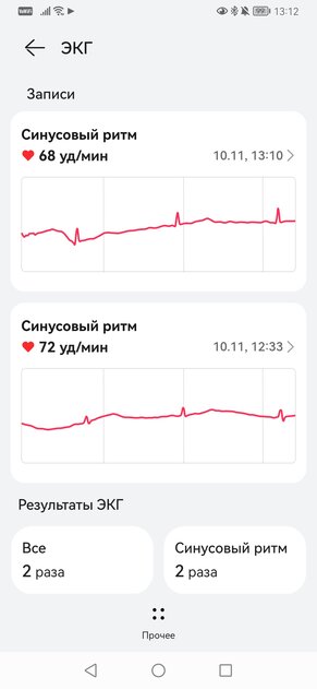 Обзор Huawei Watch D: эти часы умеют измерять артериальное давление — Что ещё могут смарт-часы?. 32