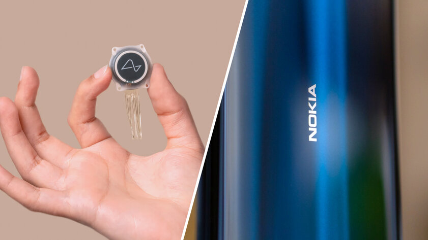 Что там в IT: первый человек с чипом Neuralink, GPT в Госуслугах, HMD вместо Nokia