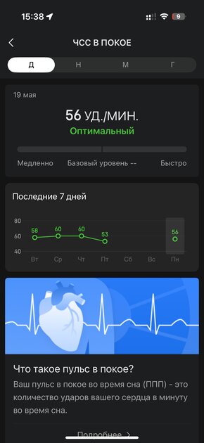 Вы все это время неправильно пользовались умными часами: 10 дней с Amazfit Bip 6