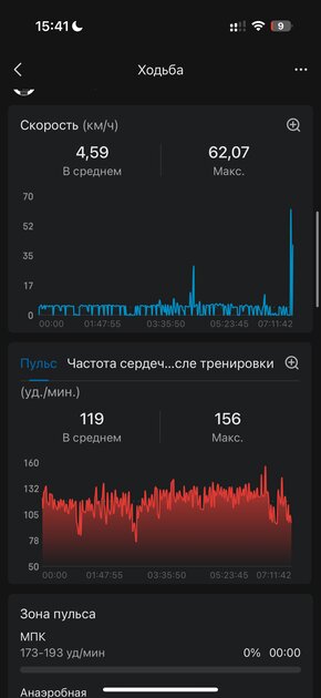 Вы все это время неправильно пользовались умными часами: 10 дней с Amazfit Bip 6