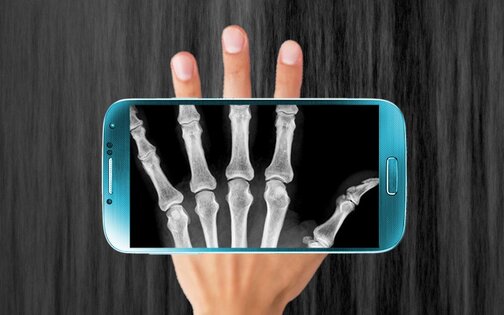 X-Ray Сканер 1.1.6. Скриншот 2