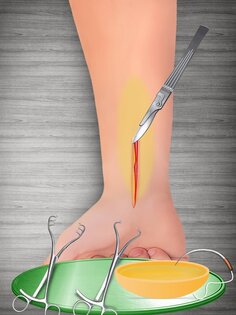 Bone Doctor Wrist Surgery 2.0.5. Скриншот 11