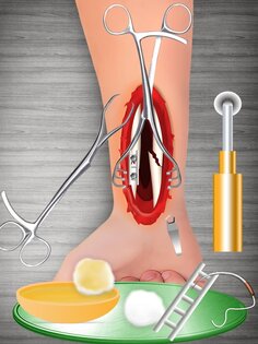 Bone Doctor Wrist Surgery 2.0.5. Скриншот 12