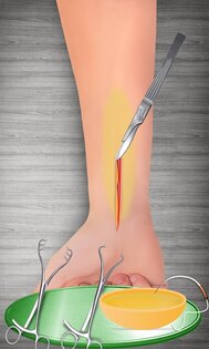 Bone Doctor Wrist Surgery 2.0.5. Скриншот 18