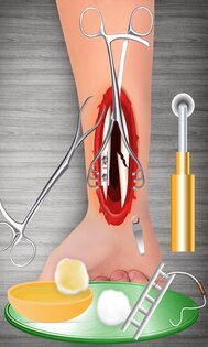 Bone Doctor Wrist Surgery 2.0.5. Скриншот 19