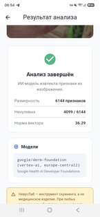 НевусЛаб 1.0.0. Скриншот 3