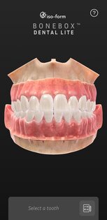 BoneBox – Dental Lite 2.0.2. Скриншот 1
