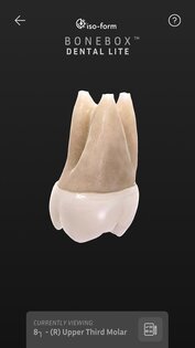BoneBox – Dental Lite 2.0.2. Скриншот 2