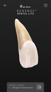 BoneBox – Dental Lite 2.0.2. Скриншот 3