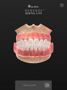BoneBox – Dental Lite 2.0.2. Скриншот 8
